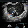 Ультразвуковой аппарат GE Healthcare Voluson E6 