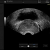 Ультразвуковой аппарат GE Healthcare Versana Essential 
