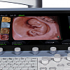 Ультразвуковой аппарат GE Healthcare Voluson E8 