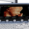 Ультразвуковой аппарат GE Healthcare Voluson E6 